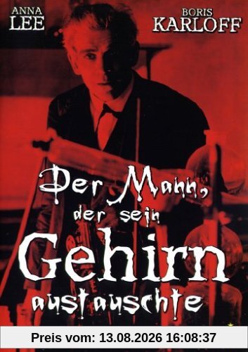 Der Mann, der sein Gehirn austauschte