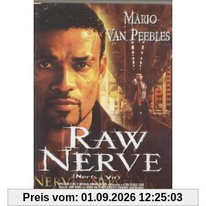Raw Nerve