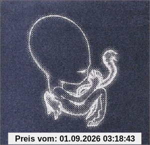 Agaetis Byrjun