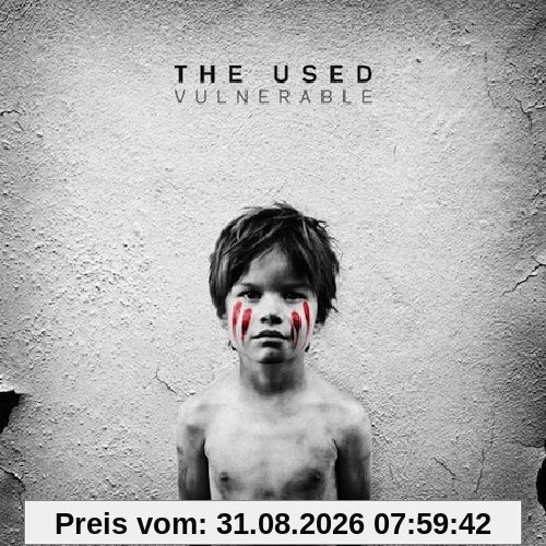 Vulnerable