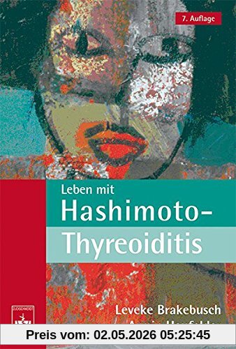 Leben mit Hashimoto-Thyreoiditis: Ein Ratgeber