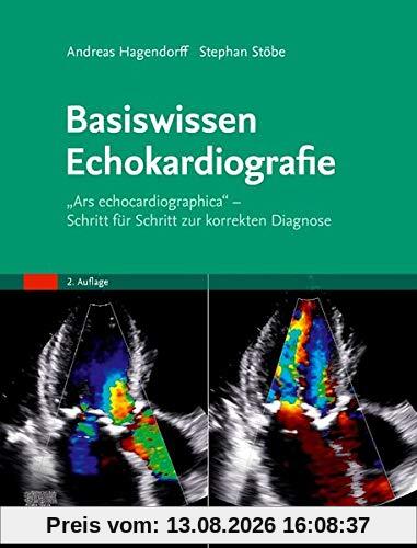 Basiswissen Echokardiografie: Ars echocardiographica - Schritt für Schritt zur korrekten Diagnose