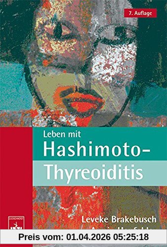 Leben mit Hashimoto-Thyreoiditis: Ein Ratgeber