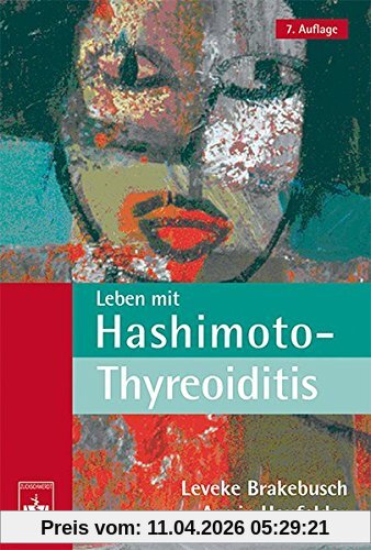 Leben mit Hashimoto-Thyreoiditis: Ein Ratgeber