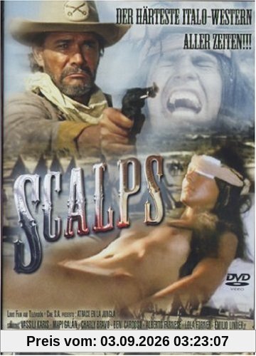 Scalps