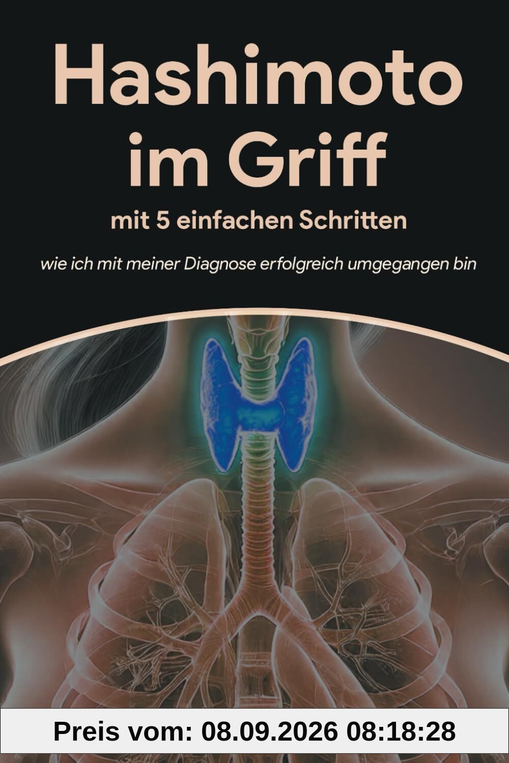 Hashimoto im Griff mit 5 einfachen Schritten: wie ich mit meiner Diagnose erfolgreich umgegangen bin