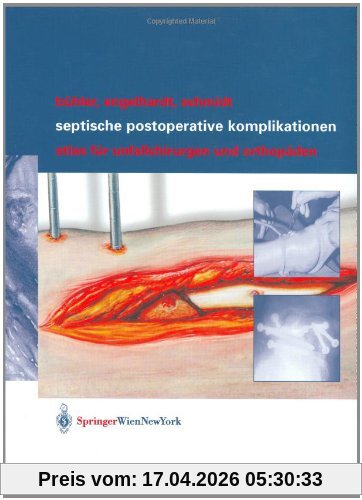 Septische postoperative Komplikationen: Atlas für Unfallchirurgen und Orthopäden