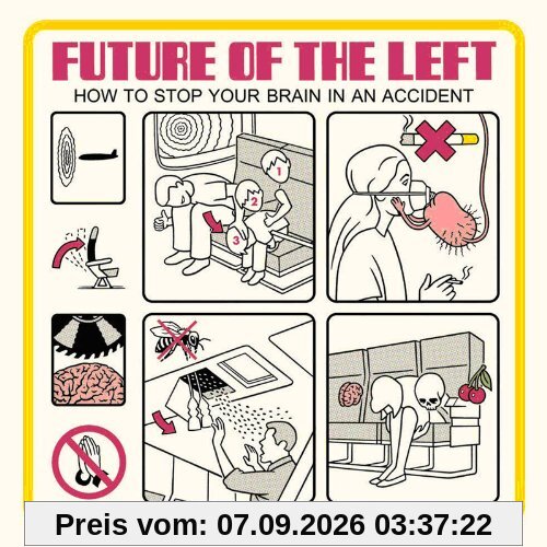 How to Stop Your Brain in An Accident