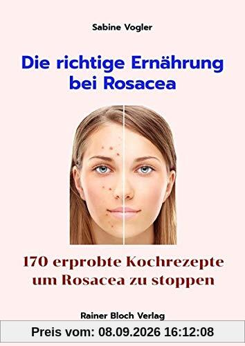 Die richtige Ernährung bei Rosacea: 170 erprobte Kochrezepte um Rosacea zu stoppen