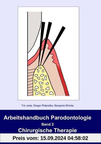 Arbeitshandbuch Parodontologie: Band 2: Chirurgische Therapie