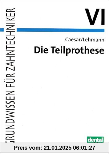 Grundwissen für Zahntechniker / Die Teilprothese